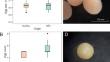 Lipid composition of coral propagules and reproductive material in coral restoration nurseries