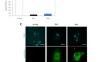 Identification of a new human senescent skin cell marker ribonucleoside-diphosphate reductase subunit M2 B