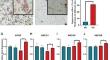 Multi-omics analysis of the lipid-regulating effects of metformin in a glucose concentration-dependent manner in macrophage-derived foam cells.