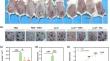 The treatment of Tofacitinib for rosacea through the inhibition of the JAK/STAT signaling pathway.