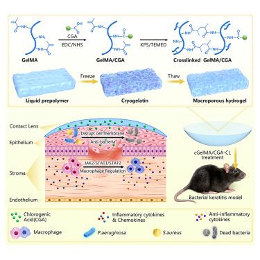 Immunoregulatory cryogel-based contact lenses for bacterial keratitis prevention and treatment