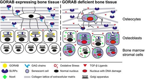 Targeting TGF-β signaling, oxidative stress, and cellular senescence rescues osteoporosis in gerodermia osteodysplastica.