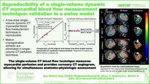 Reproducibility of a single-volume dynamic CT myocardial blood flow measurement technique: validation in a swine model.