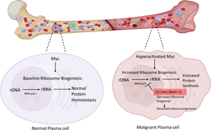 Multiple myeloma: clinical characteristics, current therapies and emerging innovative treatments targeting ribosome biogenesis dynamics.