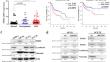 Targeting PADI2 as a potential therapeutic strategy against metastasis in oral cancer via suppressing EMT-mediated migration and invasion and CCL3/5-induced angiogenesis.