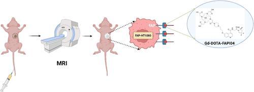 Magnetic Resonance Imaging of Fibroblast Activation Protein Using a Targeted Gadolinium-Based Contrast Agent.