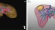 Registration accuracy comparing different rendering techniques on local vs external virtual 3D liver model reconstruction for vascular landmark setting by intraoperative ultrasound in augmented reality navigated liver resection.