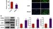 TREM2 Impairs Glycolysis to Interrupt Microglial M1 Polarization and Inflammation via JAK2/STAT3 Axis.