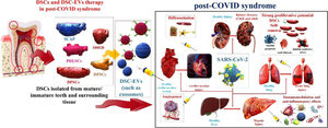 The Role of Dental-derived Stem Cell-based Therapy and Their Derived Extracellular Vesicles in Post-COVID-19 Syndrome-induced Tissue Damage.