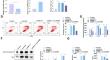 Regulatory axis of circular RNA DTNB, microRNA-485-5p, and myeloid cell leukemia 1 attenuates inflammation and apoptosis in caerulein-treated AR42J cells