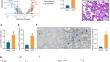 MYOCD and SRF-mediated MLCK transcription prevents polymorphonuclear neutrophils from ferroptosis in sepsis-related acute lung injury.