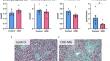 Oral pyrophosphate protects Abcc6<sup>-/-</sup> mice against vascular calcification induced by chronic kidney disease.