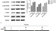 Correction to: Histone Deacetylase Inhibitor RGFP109 Overcomes Temozolomide Resistance by Blocking NF-κB-Dependent Transcription in Glioblastoma Cell Lines.