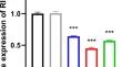 In vitro silencing of RIP2 in naive CD4<sup>+</sup> T cells from lupus-prone mice promotes pathogenic Th17 cell differentiation.