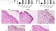 Quercetin Alleviates the Progression of Chronic Rhinosinusitis Without Nasal Polyps by Inhibiting Nasal Mucosal Inflammation and Epithelial Apoptosis.