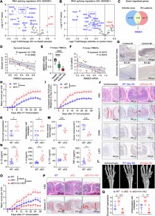 RBM25 is required to restrain inflammation via ACLY RNA splicing-dependent metabolism rewiring