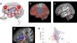 On the role of the arcuate fasciculus in word production and repetition: a reply to Van den Hoven et al. (2024).