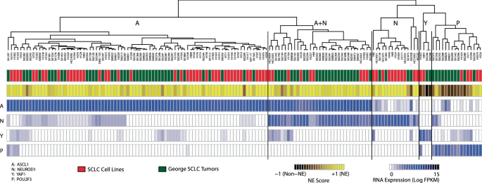 Jumonji histone demethylases are therapeutic targets in small cell lung cancer