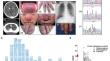 Immunophenotyping and Therapeutic Insights from Chronic Mucocutaneous Candidiasis Cases with STAT1 Gain-of-Function Mutations.