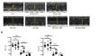 The Gut Microbiota Mediates the Protective Effects of Spironolactone on Myocardial Infarction.