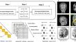 Differential Effects of Continuous Theta Burst Stimulation over the Bilateral and Unilateral Cerebellum on Working Memory.