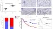 NFS1 inhibits ferroptosis in gastric cancer by regulating the STAT3 pathway