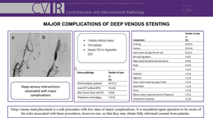 Major Complications of Deep Venous Stenting.