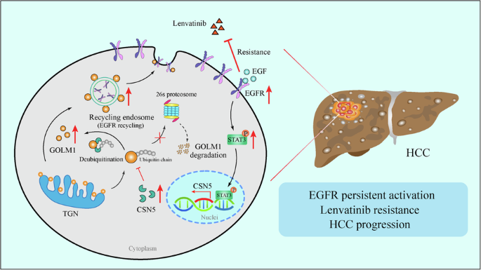 GOLM1 dictates acquired Lenvatinib resistance by a GOLM1-CSN5 positive feedback loop upon EGFR signaling activation in hepatocellular carcinoma