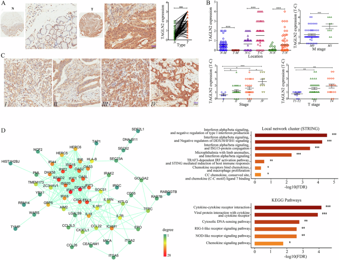 TAGLN2 induces resistance signature ISGs by activating AKT-YBX1 signal with dual pathways and mediates the IFN-related DNA damage resistance in gastric cancer.