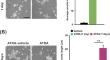 Distinct In Vitro Differentiation Protocols Differentially Affect Cytotoxicity Induced by Heavy Metals in Human Neuroblastoma SH-SY5Y Cells.