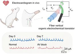 Fast-response fiber organic electrochemical transistor with vertical channel design for electrophysiological monitoring†