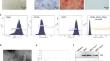 Mesenchymal stem cells-derived exosomes alleviate liver fibrosis by targeting Hedgehog/SMO signaling.