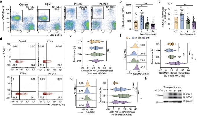 The different paradigms of NK cell death in patients with severe trauma.