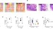 Shenling Baizhu powder attenuates lard diet in a fatigued state-induced diarrhea via targeting microbial metabolites short chain fatty acids-mediated lipid metabolism.