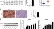 PODXL promotes malignant progression of hepatocellular carcinoma by activating PI3K/AKT pathway.