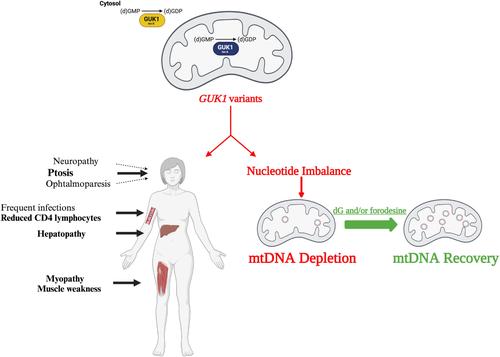 Guanylate Kinase 1 Deficiency: A Novel and Potentially Treatable Mitochondrial DNA Depletion/Deletions Disease