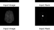 Fully convolutional neural network-based segmentation of brain metastases: a comprehensive approach for accurate detection and localization