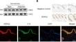 NDRG2 Deficiency Exacerbates UVB-Induced Skin Inflammation and Oxidative Stress Damage.