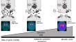 The akinetic crisis in Parkinson´s disease- the upper end of a spectrum of subacute akinetic states.