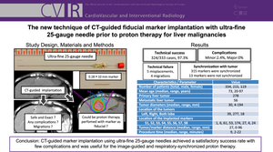 CT-Guided Fiducial Marker Implantation with Ultra-fine 25-Gauge Needle Prior to Proton Therapy for Liver Malignancies.