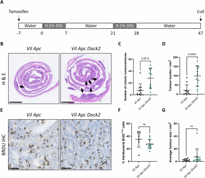 Loss of DOCK2 potentiates Inflammatory Bowel Disease-associated colorectal cancer via immune dysfunction and IFNγ induction of IDO1 expression.