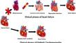 “Emerging clinical approaches in diabetic cardiomyopathy: insights from clinical trials and future directions”