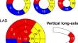 A novel algorithm developed using machine learning and a J-ACCESS database can estimate defect scores from myocardial perfusion single-photon emission tomography images.