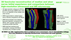 3D fascicular reconstruction of median and ulnar nerve: initial experience and comparison between high-resolution ultrasound and MR microscopy.