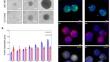 Blood-tumor barrier in focus - investigation of glioblastoma-induced effects on the blood-brain barrier.