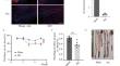 GDNF's Role in Mitigating Intestinal Reactive Gliosis and Inflammation to Improve Constipation and Depressive Behavior in Rats with Parkinson’s disease