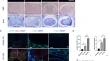 Microglia Promote Lymphangiogenesis Around the Spinal Cord Through VEGF-C/VEGFR3-Dependent Autophagy and Polarization After Acute Spinal Cord Injury.