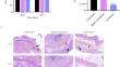 The role of male hormones in bacterial infections: enhancing Staphylococcus aureus virulence through testosterone-induced Agr activation