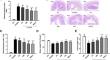 Rutin Ameliorates Inflammation and Oxidative Stress in Ulcerative Colitis by Inhibiting NLRP3 Inflammasome Signaling Pathway.