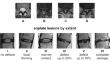 Association between MRI measurements of lumbar spine alterations and self-reported outcomes of pain and disability in subjects with non-specific low back pain.